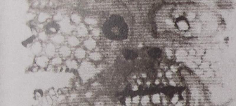 Ce détail d'un dessin de Victor Hugo représente un visage vu de face et de côté, comme saisi aux rayons X.