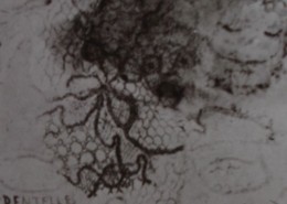 Ce détail d'un dessin de Victor Hugo représente un visage en haut à droite, un autre en diagonale ainsi qu'un lézard stylisé (ou un dinosaure) et de la dentelle avec, en bas à gauche, le mot « DENTELLES ».